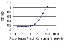 Anti-KLK2 Mouse Monoclonal Antibody [clone: 3C5]