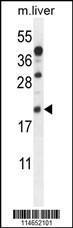 Anti-AIF1 Rabbit Polyclonal Antibody (FITC (Fluorescein Isothiocyanate))