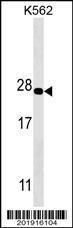 Anti-PSMA5 Mouse Monoclonal Antibody (FITC (Fluorescein Isothiocyanate)) [clone: 426CT8.5.1]