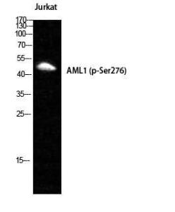 Antibody anti-AML1 phospho SER276 100 µg