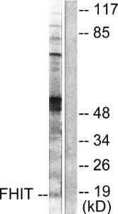 Antibody anti-FHIT A98890-100 100 µg