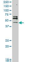 Anti-STK32C Mouse Monoclonal Antibody [clone: 3E8]