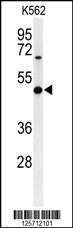 Anti-B3GAT1 Rabbit Polyclonal Antibody (HRP (Horseradish Peroxidase))