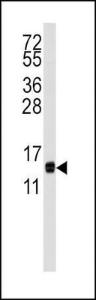 Anti-CDA Rabbit Polyclonal Antibody