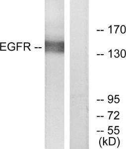 Western blot analysis of lysates from A431 cells, treated with EGF 40muM 10' using Anti-EGFR Antibody The right hand lane represents a negative control, where the antibody is blocked by the immunising peptide