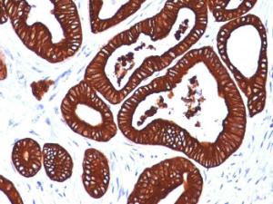 Immunohistochemical analysis of formalin-fixed, paraffin-embedded human colon using Anti-Cytokeratin 19 Antibody [BA17]