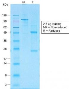 SDS-PAGE analysis of Anti-CD30 Antibody [Ki-1/1505R] under non-reduced and reduced conditions; showing intact IgG and intact heavy and light chains, respectively. SDS-PAGE analysis confirms the integrity and purity of the antibody