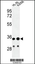 Anti-PTGIR Rabbit Polyclonal Antibody