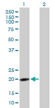 Anti-NPM3 Mouse Polyclonal Antibody