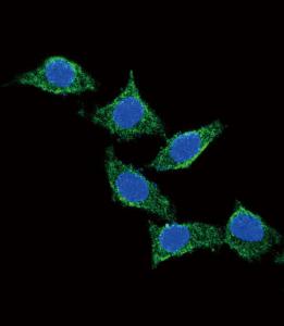 Anti-ADCYAP1 Rabbit Polyclonal Antibody