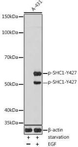 Western blot analysis of extracts of A-431 cells, using Anti-SHC (phospho Tyr427) Antibody (A308256) at 1:1,000 dilutio