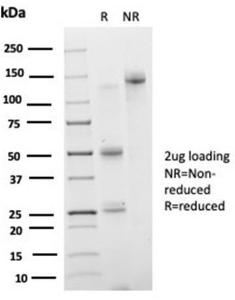 SDS-PAGE analysis of Anti-IRF3 Antibody [PCRP-IRF3-3B2] under non-reduced and reduced conditions; showing intact IgG and intact heavy and light chains, respectively. SDS-PAGE analysis confirms the integrity and purity of the antibody.