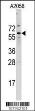 Anti-CDC25B Rabbit Polyclonal Antibody