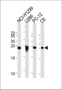 Anti-UCHL1 Rabbit Polyclonal Antibody (HRP (Horseradish Peroxidase))