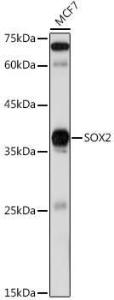 Western blot analysis of extracts of MCF7 cells, using Anti-SOX2 Antibody (A12651) at 1:1,000 dilution. The secondary antibody was Goat Anti-Rabbit IgG H&L Antibody (HRP) at 1:10,000 dilution.