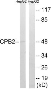 Western blot analysis of lysates from HepG2 cells using Anti-CPB2 Antibody. The right hand lane represents a negative control, where the Antibody is blocked by the immunising peptide