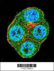 Anti-BTRC Rabbit Polyclonal Antibody (Biotin)