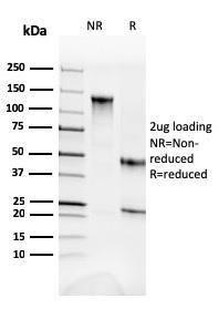 SDS-PAGE analysis of Anti-alpha Fodrin Antibody [SPTAN1/3352] under non-reduced and reduced conditions; showing intact IgG and intact heavy and light chains, respectively. SDS-PAGE analysis confirms the integrity and purity of the antibody.