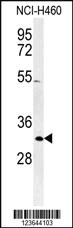 Anti-XPA Rabbit Polyclonal Antibody