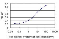 Anti-PPIL2 Mouse Monoclonal Antibody [clone: 2E11]