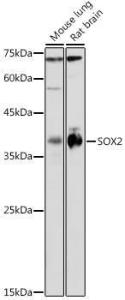 Western blot analysis of extracts of various cell lines, using Anti-SOX2 Antibody (A12651) at 1:1,000 dilution. The secondary antibody was Goat Anti-Rabbit IgG H&L Antibody (HRP) at 1:10,000 dilution.