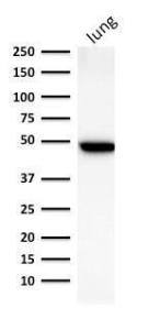 Western blot analysis of human lung lysate using Anti-Cytokeratin 19 Antibody [BA17]