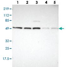 Anti-PSMC1 Rabbit Polyclonal Antibody