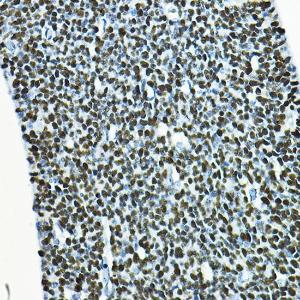 Immunohistochemistry analysis of paraffin-embedded mouse embryos using Anti-SOX2 Antibody (A12651) at a dilution of 1:100 (40x lens). Perform high pressure antigen retrieval with 10 mM citrate buffer pH 6.0 before commencing with IHC staining protocol.