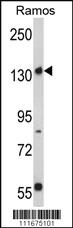 Anti-RICTOR Rabbit Polyclonal Antibody