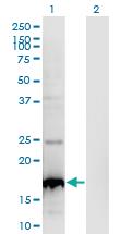 Anti-BLOC1S2 Mouse Monoclonal Antibody [clone: 8C10]