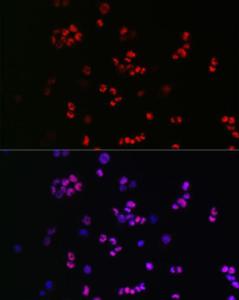 Immunofluorescence analysis of F9 cells using Anti-SOX2 Antibody (A12651) at a dilution of 1:50 (40x lens). DAPI was used to stain the cell nuclei (blue).