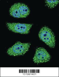 Anti-PAK6 Rabbit Polyclonal Antibody