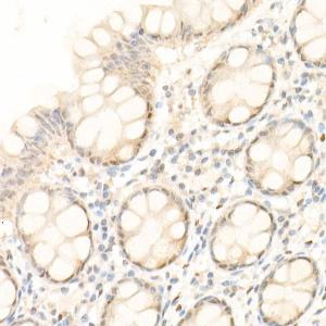 Immunohistochemistry analysis of paraffin-embedded human colon tissue using Anti-YAP1 Antibody (A308257) at a dilution of 1:20 (40x lens). Perform high pressure antigen retrieval with 10 mM citrate buffer pH 6.0 before commencing with IHC staining protocol.