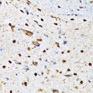 Immunohistochemistry analysis of paraffin-embedded mouse spinal cord using Anti-CAMKIV Antibody [ARC1506] (A305710) at a dilution of 1:100 (40x lens) Perform microwave antigen retrieval with 10 mM Tris/EDTA buffer pH 90 before commencing with IHC staining protocol