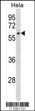 Anti-CYP7B1 Rabbit Polyclonal Antibody