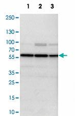 Anti-PSMC1 Rabbit Polyclonal Antibody