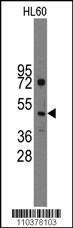 Anti-IHH Rabbit Polyclonal Antibody (AP (Alkaline Phosphatase))