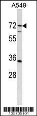 Anti-CDADC1 Rabbit Polyclonal Antibody (HRP (Horseradish Peroxidase))