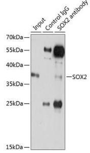 Immunoprecipitation analysis of 200µg extracts of C6 cells using 3µg of Anti-SOX2 Antibody (A12651). This Western blot was performed on the immunoprecipitate using Anti-SOX2 Antibody (A12651) at a dilution of 1:500.