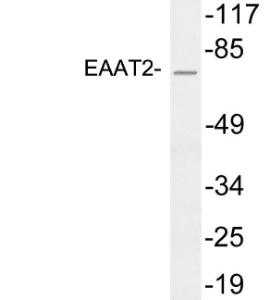 Western blot analysis of lysates from HeLa cells using Anti-EAAT2 Antibody