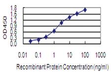 Anti-BLOC1S2 Mouse Monoclonal Antibody [clone: 8C10]