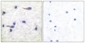 Immunohistochemical analysis of paraffin-embedded human brain using Anti-Tau (phospho Thr212) Antibody. The right hand panel represents a negative control, where the antibody was pre-incubated with the immunising peptide.