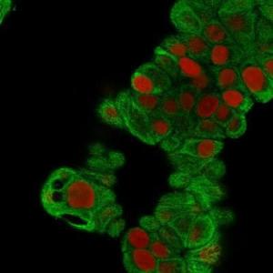 Immunofluorescent analysis of methanol fixed MCF-7 cells stained with Anti-Cytokeratin 19 Antibody [BA17] followed by Goat Anti-Mouse IgG (CF&#174; 488) (Green). The nuclear counterstain is RedDot (Red)