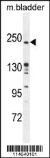 Anti-RICTOR Rabbit Polyclonal Antibody