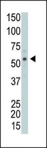 Anti-PICK1 Rabbit Polyclonal Antibody (HRP (Horseradish Peroxidase))