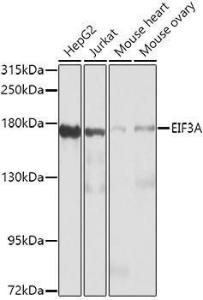 Western blot analysis of extracts of various cell lines, using Anti-eIF3A Antibody (A12654) at 1:1000 dilution