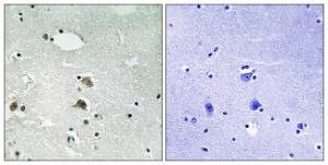 Immunohistochemical analysis of paraffin-embedded human brain tissue using Anti-S6 Ribosomal Protein Antibody. The right hand panel represents a negative control, where the Antibody was pre-incubated with the immunising peptide