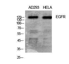 Western blot analysis of various cells using Anti-EGFR Antibody