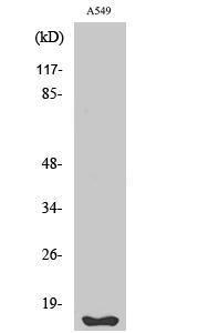 Antibody anti-FHIT A98890-100 100 µg