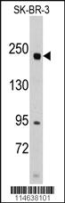 Anti-RICTOR Rabbit Polyclonal Antibody